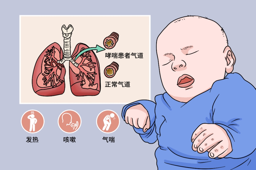 儿童哮喘知多少：认识、预防与日常管理