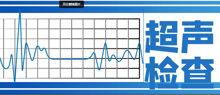 心脏跳动的守护者：超声心动图检查全攻略